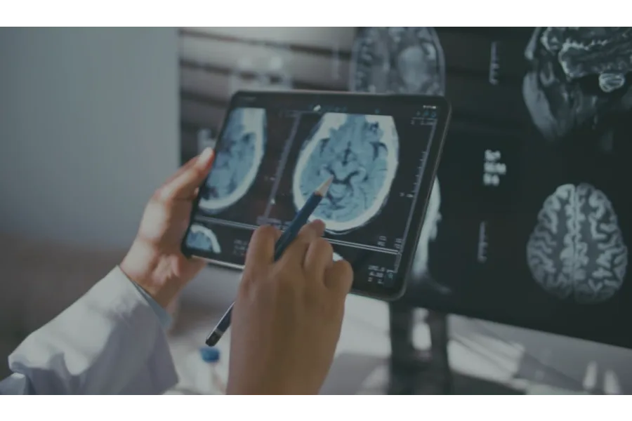 Brain Cancer and Medical Marijuana