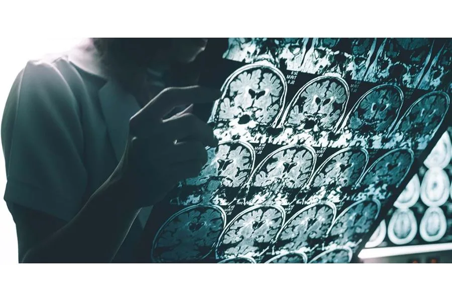 Texas Drafts Definition for Incurable Neurodegenerative Diseases That Qualify for Medical Cannabis