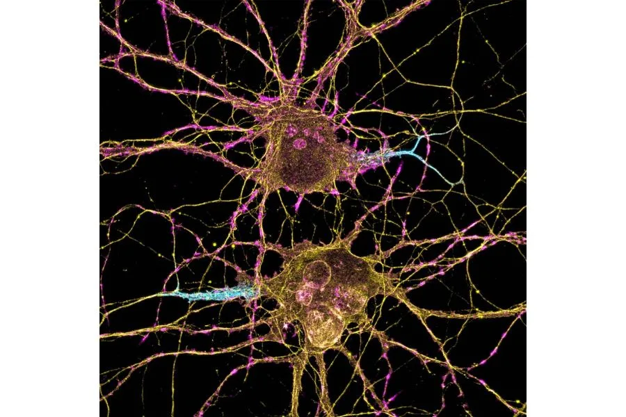 Cannabis for PTSD: What Science Says